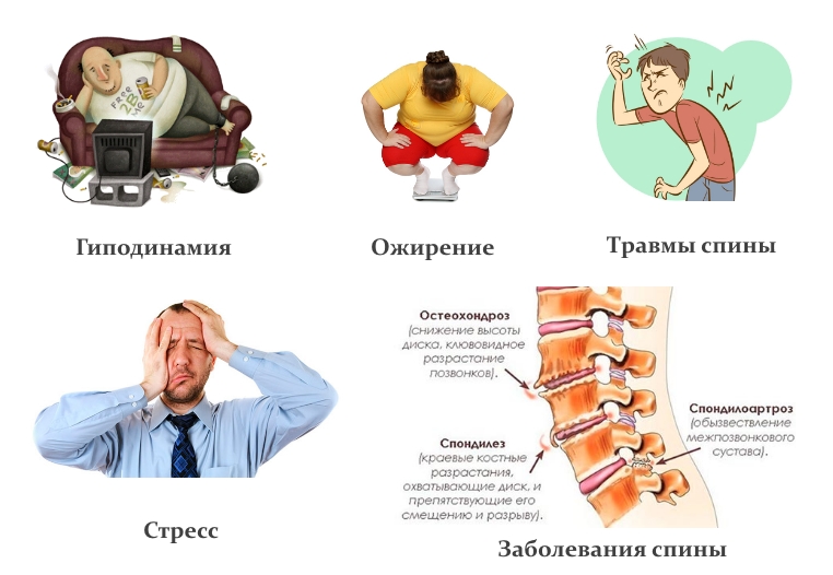 Частые причины боли в спине Частые причины боли в спине