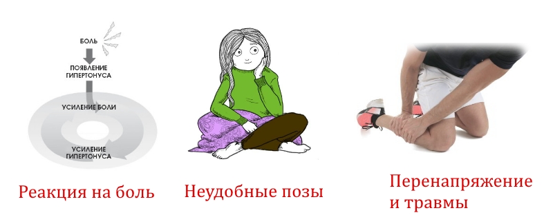 Причины гипертонуса мышц Причины гипертонуса мышц