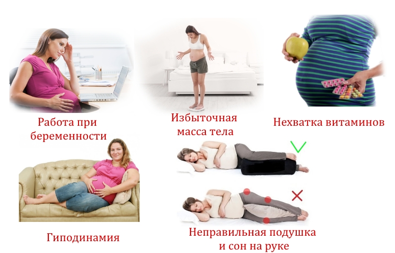 Причины онемения рук при беременности Причины онемения рук при беременности