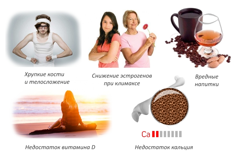 Причины остеопороза Причины остеопороза