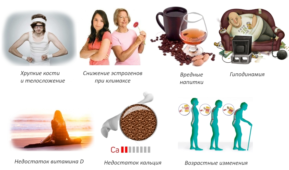Частые причины остеопороза Частые причины остеопороза