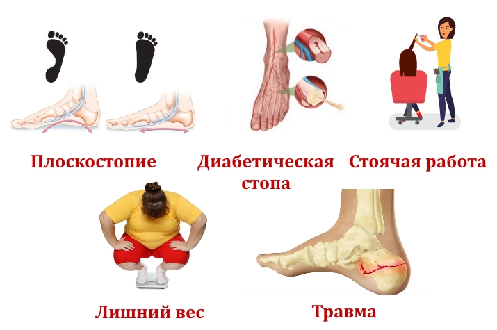 Причины пяточной кисты Причины пяточной кисты