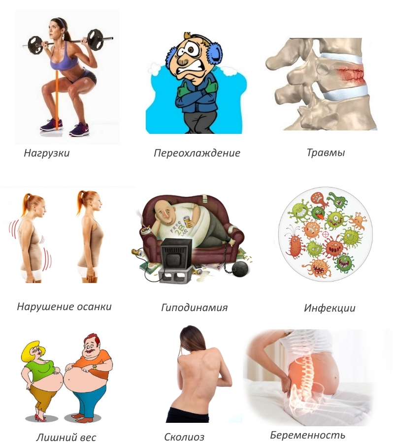 Причины радикулита и ишиаса Причины радикулита и ишиаса