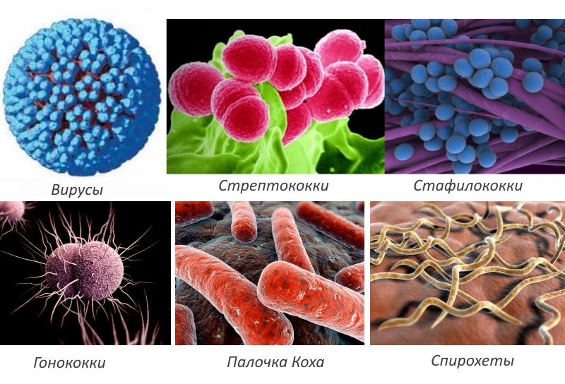 Причины реактивного артрита Причины реактивного артрита