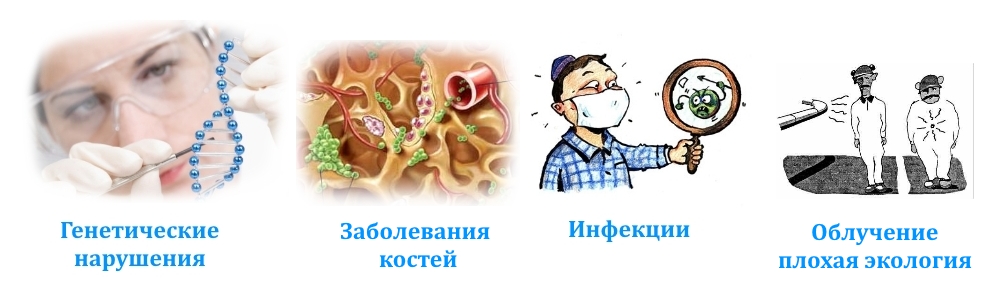 Причины саркомы бедра Причины саркомы бедра