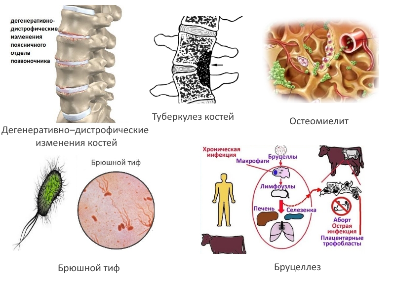 Частые причины заболевания Частые причины заболевания