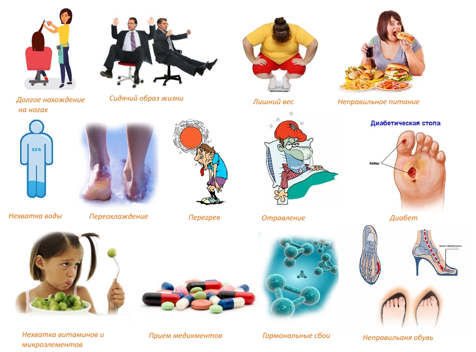 Причины судороги в стопе Причины судороги в стопе