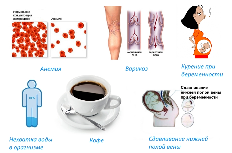 Причины судороги при беременности Причины судороги при беременности
