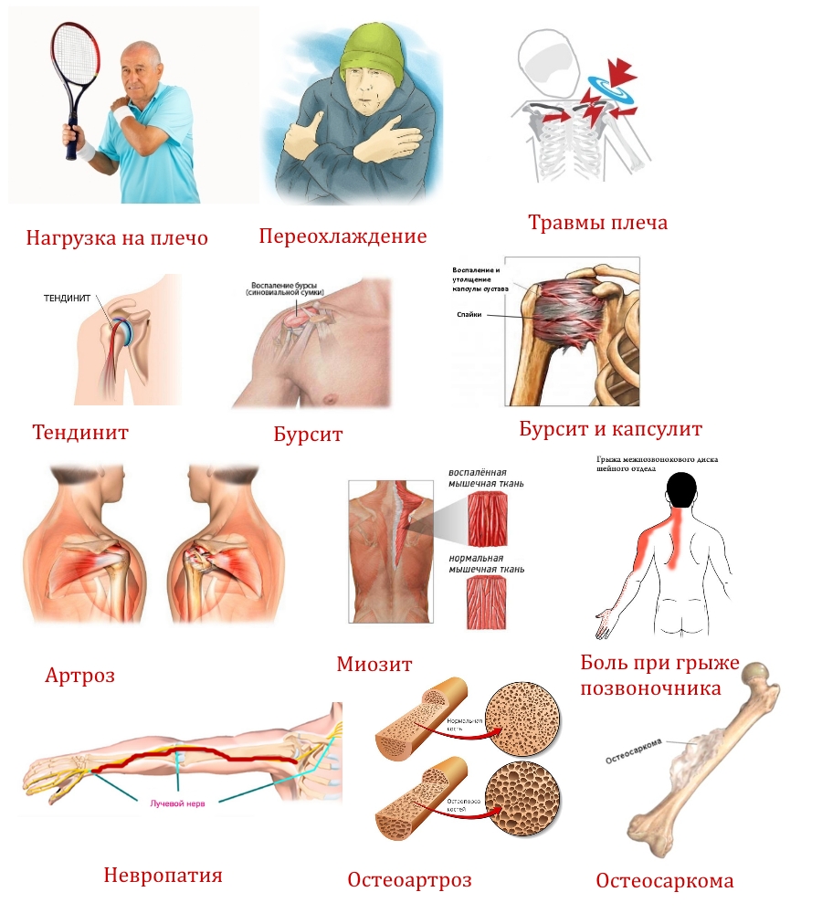 Причины болезненных ощущений Причины болезненных ощущений