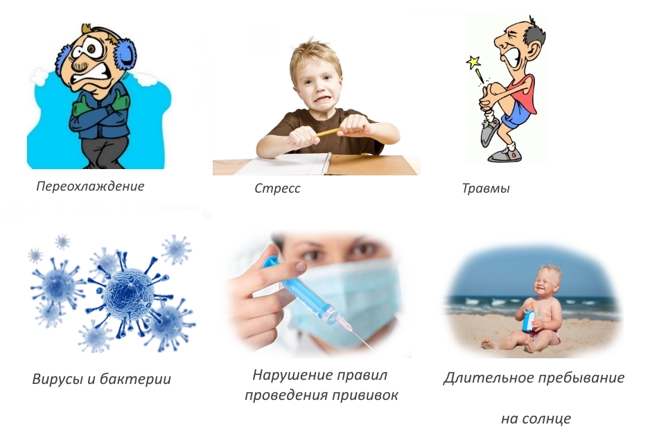 Причины ювенильного артрита Причины ювенильного артрита