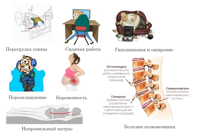 Причины защемления в спине Причины защемления в спине