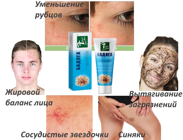 Применение Бадяга Форте Применение Бадяга Форте