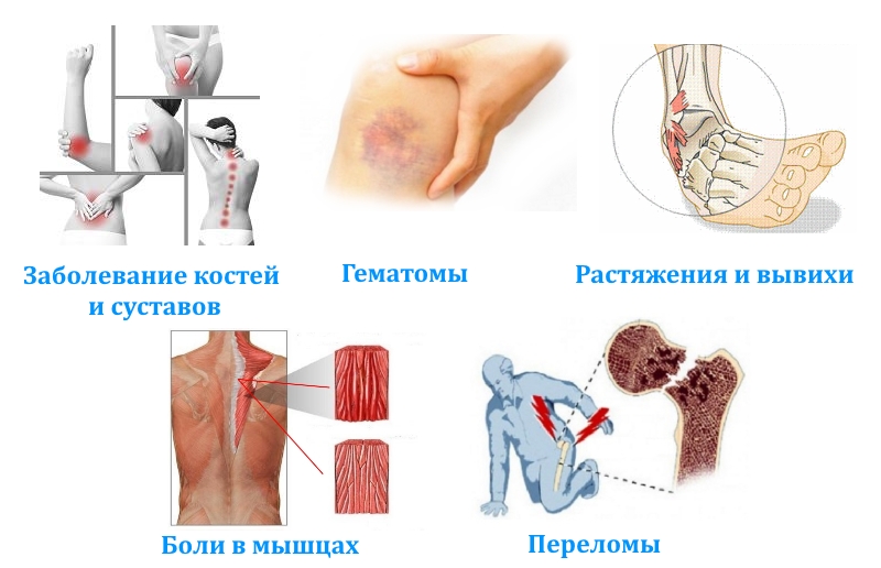 Применение Хондрофита Применение Хондрофита
