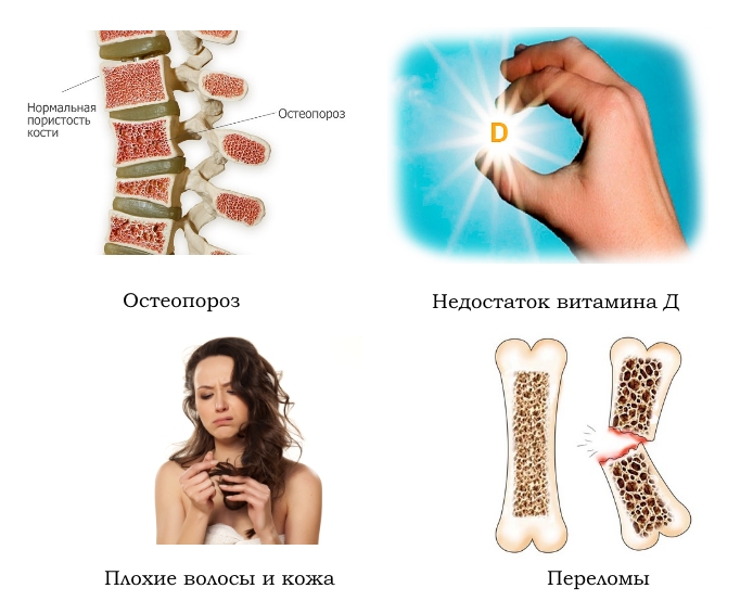 Применение Кальцепана Применение Кальцепана