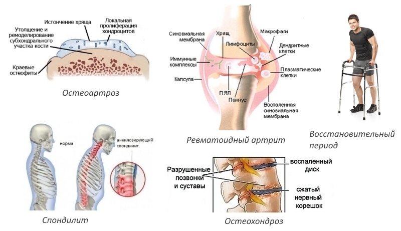 Показания к применению Мовасина Показания к применению Мовасина