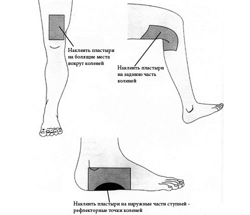 Применение лечебного пластыря Применение лечебного пластыря