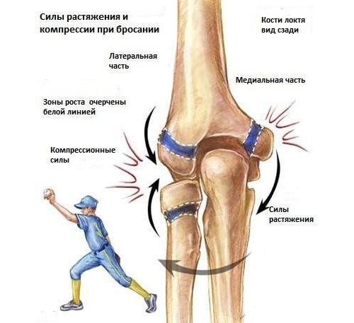 Противоборствующие силы, которые приводят к травме сустава Противоборствующие силы, которые приводят к травме сустава
