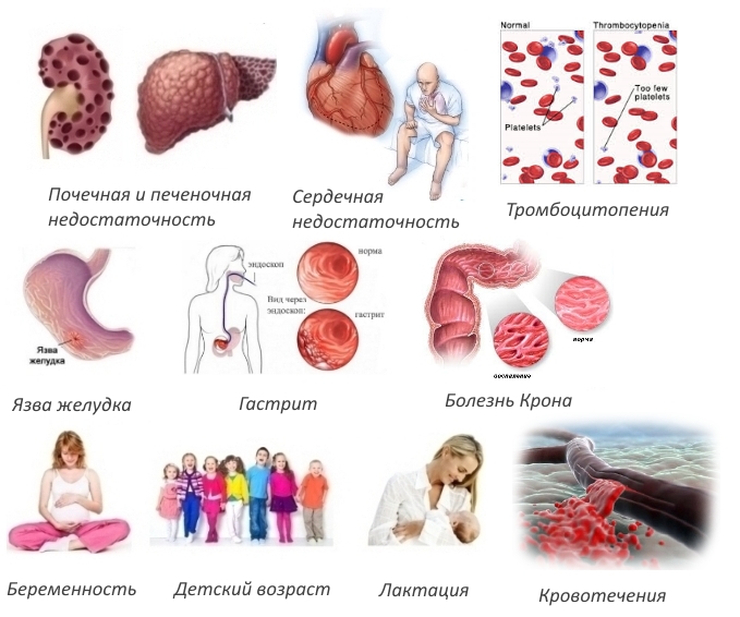 Противопоказания Ксефокама Противопоказания Ксефокама