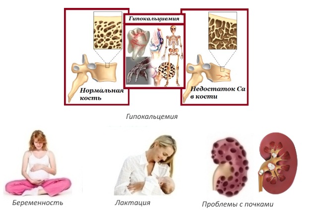 Противопоказания для Акласты Противопоказания для Акласты