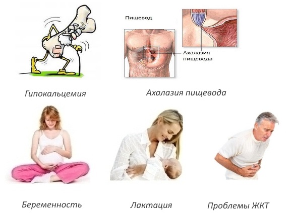 Противопоказания для Алендроновой кислоты Противопоказания для Алендроновой кислоты