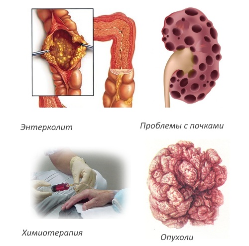 Противопоказания для Артродара Противопоказания для Артродара