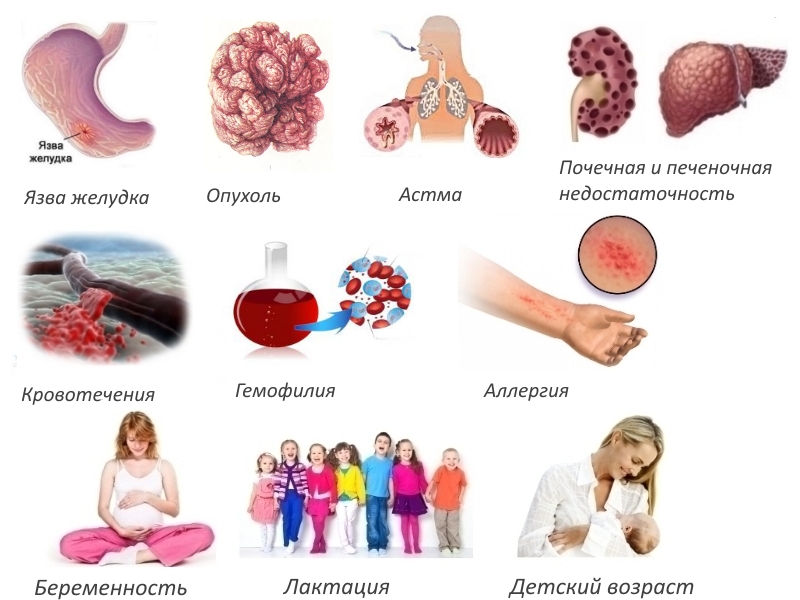 Противопоказания для Артрозана Противопоказания для Артрозана