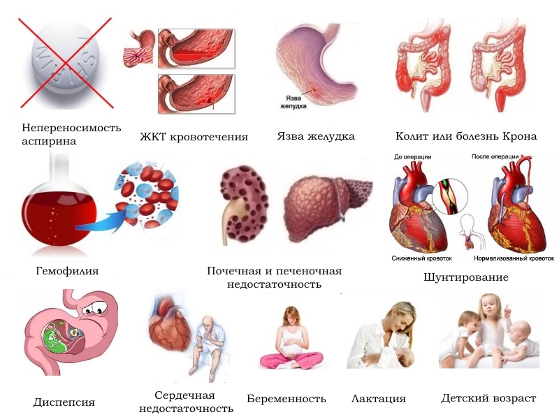 Противопоказания для Артрума Противопоказания для Артрума