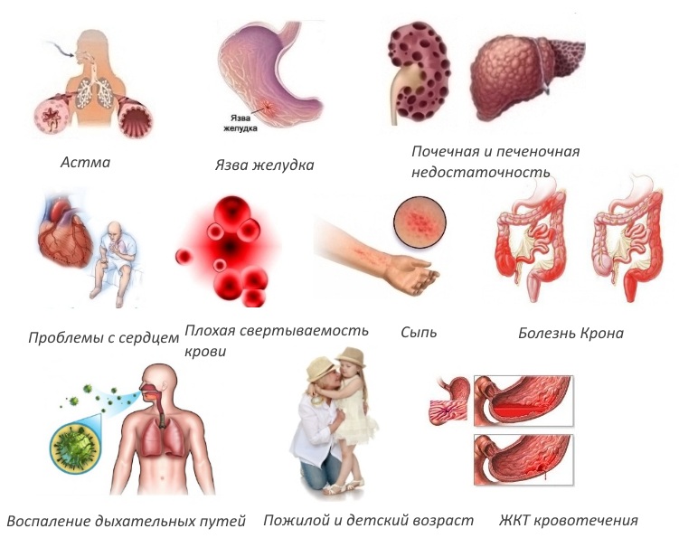 Противопоказания для Дексалгина Противопоказания для Дексалгина