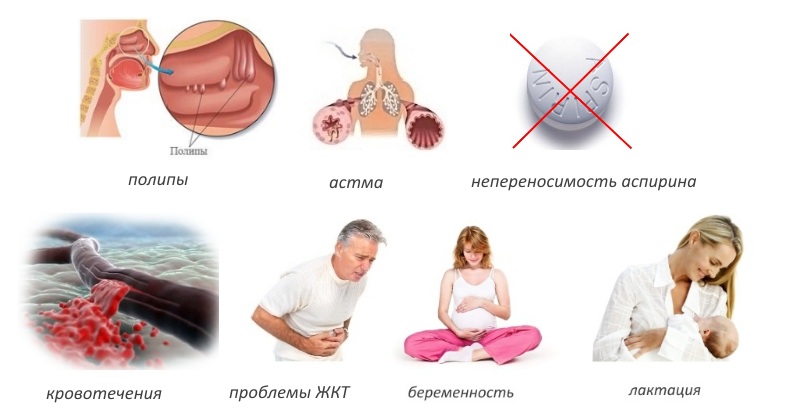 Противопоказания к Декскетопрофену Противопоказания к Декскетопрофену