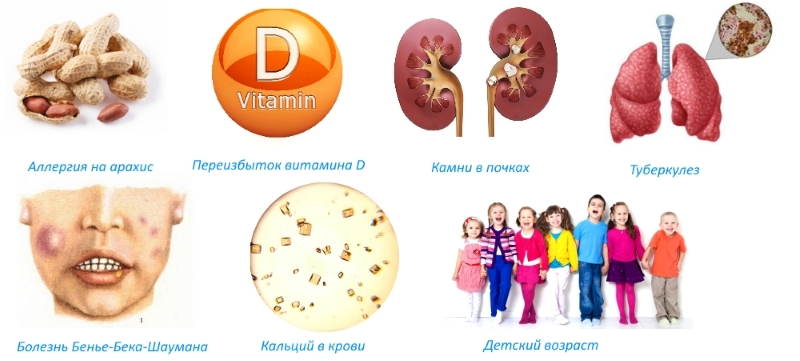 Противопоказания для Кальцемин Адванс Противопоказания для Кальцемин Адванс