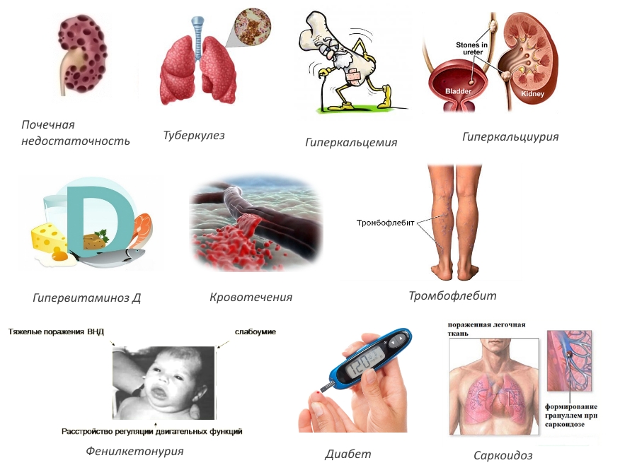 Противопоказания для Протекты Противопоказания для Протекты