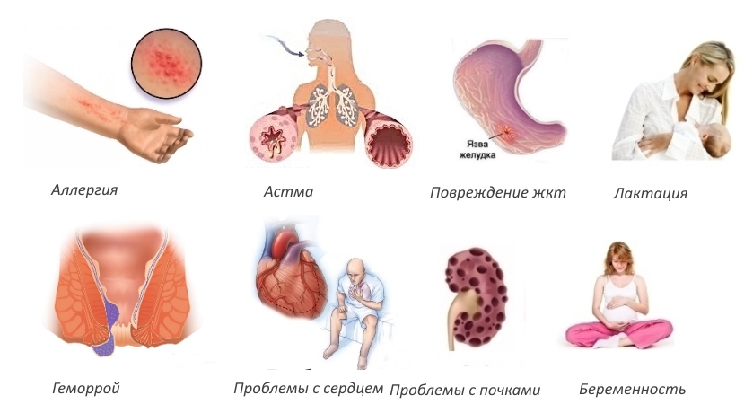 Противопоказания для Целекоксиба Противопоказания для Целекоксиба