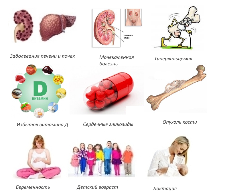 Противопоказания для Терипаратида Противопоказания для Терипаратида