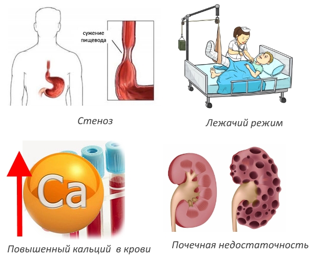 Противопоказания для Форозы Противопоказания для Форозы