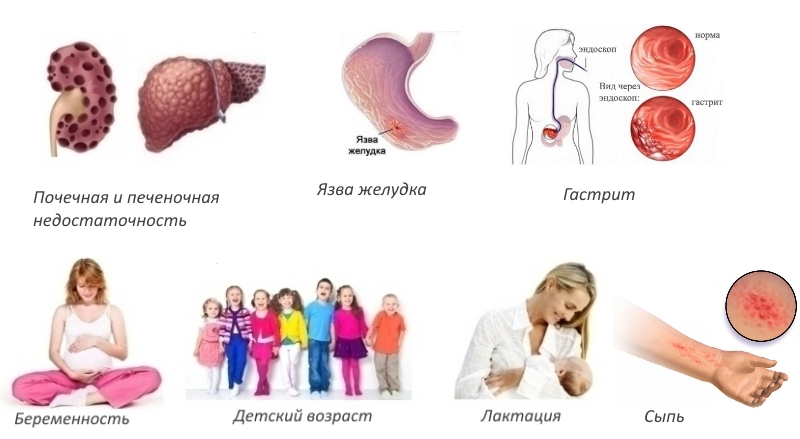 Противопоказания для геля Найз Противопоказания для геля Найз