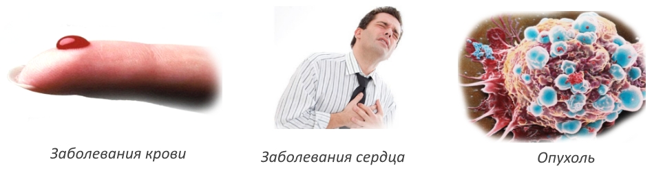 Противопоказания для гирудотерапии Противопоказания для гирудотерапии