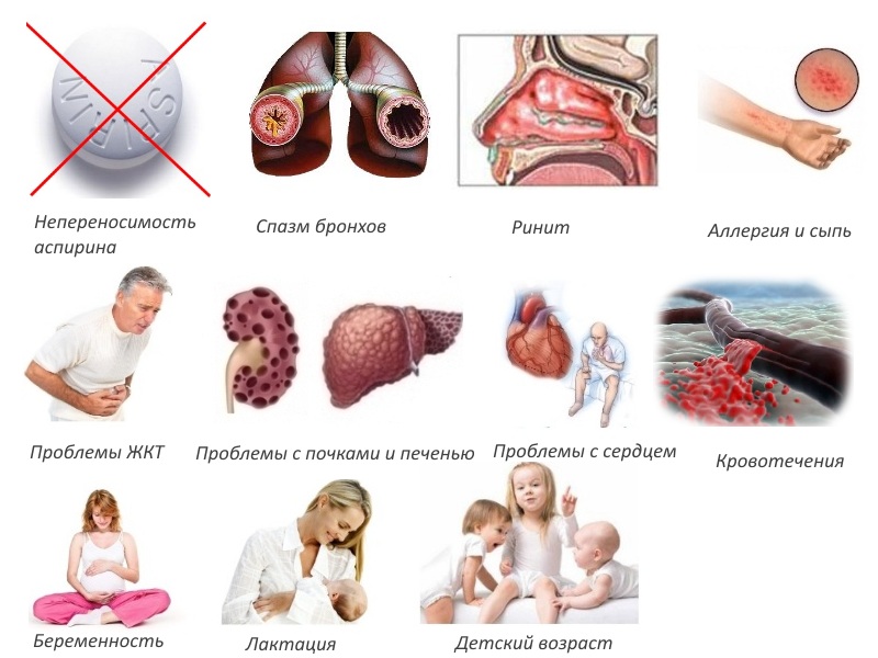 Противопоказания для инъекций Вольтарена Противопоказания для инъекций Вольтарена