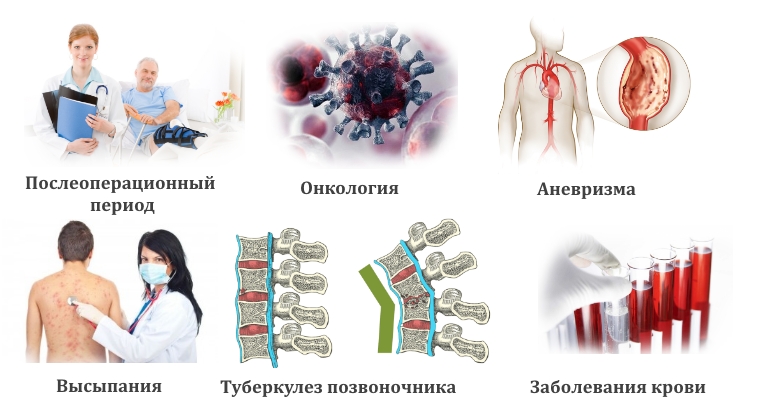 Противопоказания для массажа при боли в спине Противопоказания для массажа при боли в спине