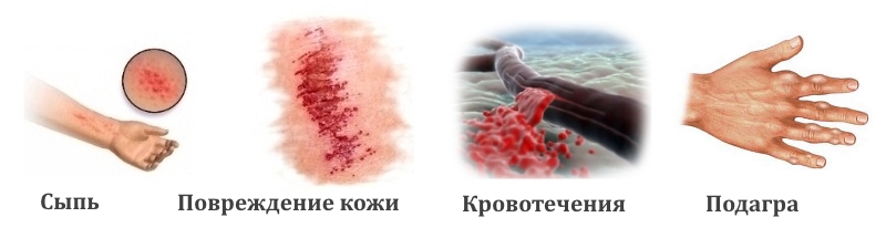 Противопоказания для ношения ортезов на палец Противопоказания для ношения ортезов на палец
