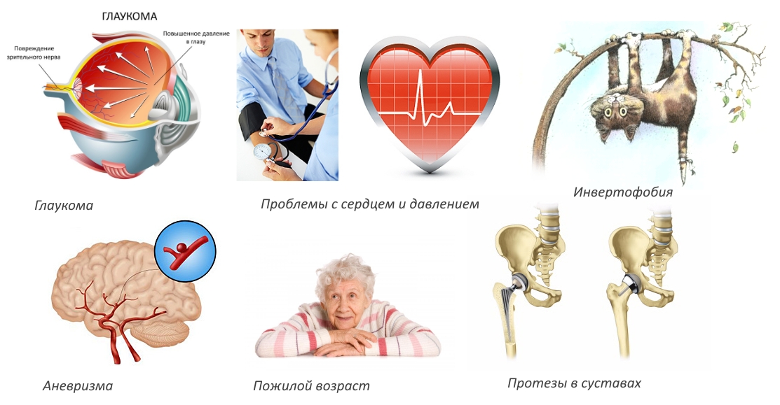 Противопоказания для применения инверсионного стола Противопоказания для применения инверсионного стола