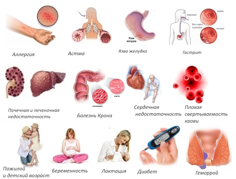 Противопоказания для свечей Мовалис Противопоказания для свечей Мовалис