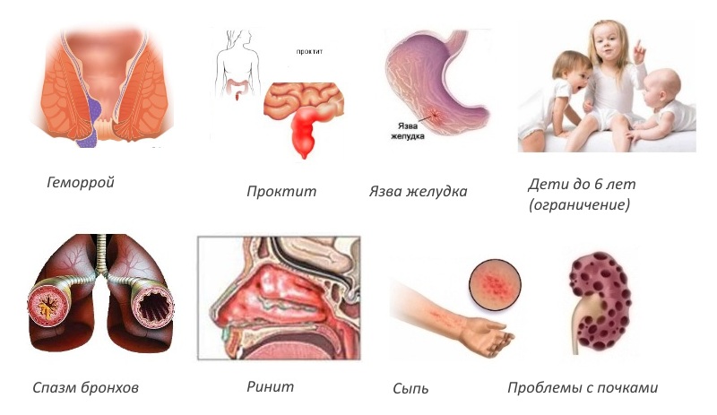 Противопоказания для свечей Вольтарен Противопоказания для свечей Вольтарен