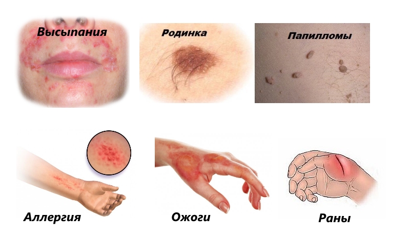 Противопоказания к Бадяга Форте Противопоказания к Бадяга Форте