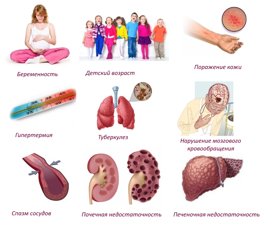 Противопоказания к использованию Салвисара Противопоказания к использованию Салвисара
