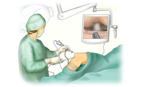 Артроскопический лаваж коленного сустава Артроскопический лаваж коленного сустава