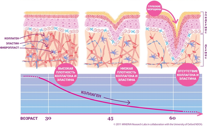Разрушение коллагена с возрастом Разрушение коллагена с возрастом
