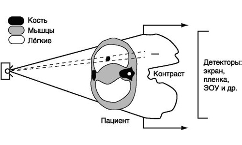 Схема формирования рентгеновского изображения Схема формирования рентгеновского изображения