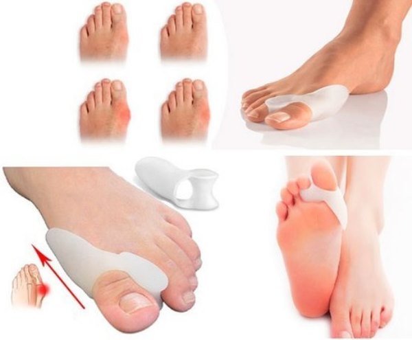 Силиконовый фиксатор от косточки на ноге Силиконовый фиксатор от косточки на ноге