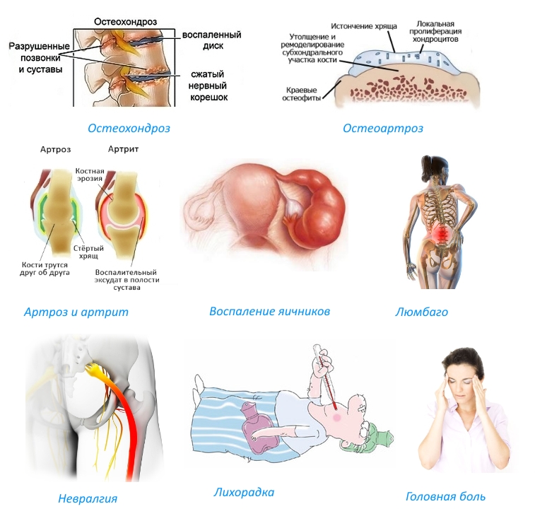 Применение свечей Дикловит Применение свечей Дикловит