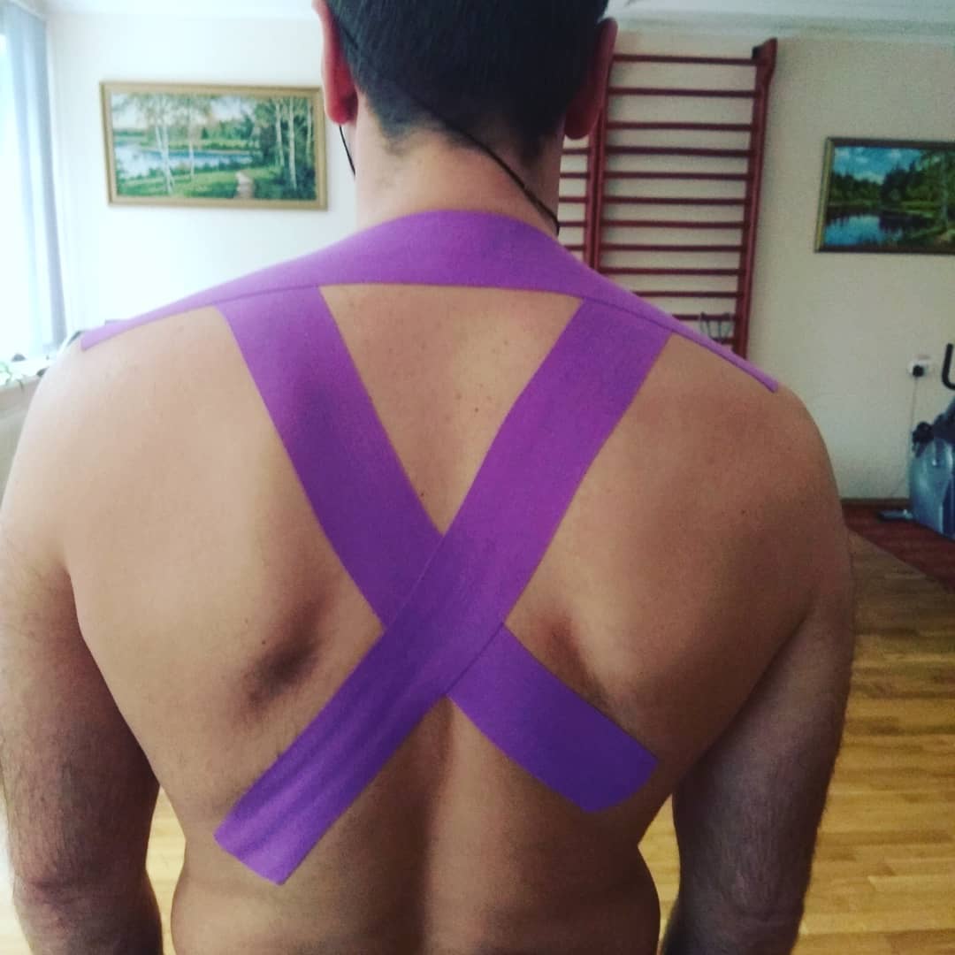 Пример тейпирования для поддержания осанки Пример тейпирования для поддержания осанки